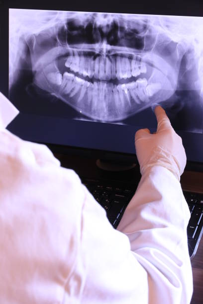Best Emergency Treatment for Dental Infections or Abscesses in Troy, TX