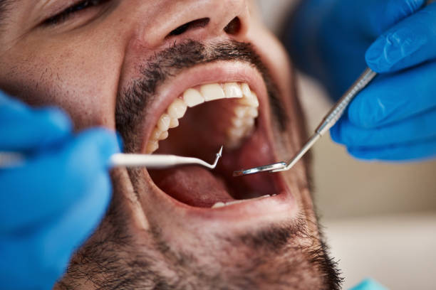 Best Emergency Tooth Extraction in Troy, TX